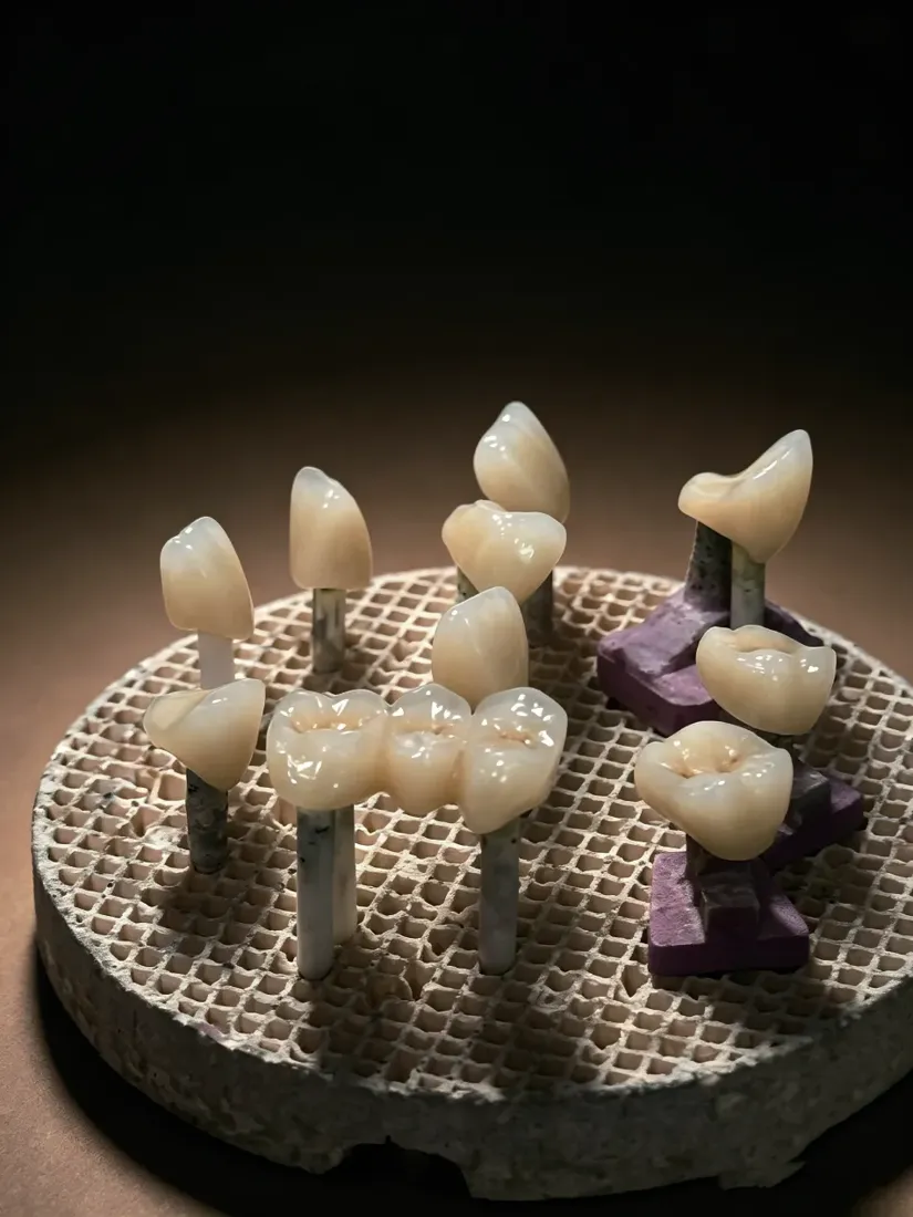 Fixed Prosthodontics