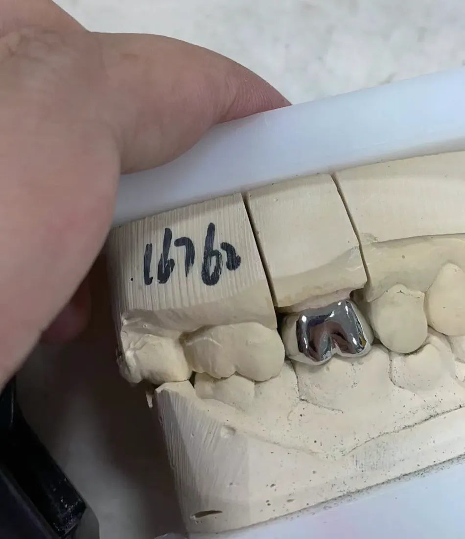 Metal crowns