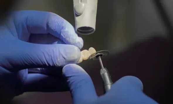 Microscope Finishing