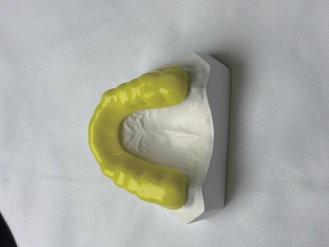 Occlusal splints