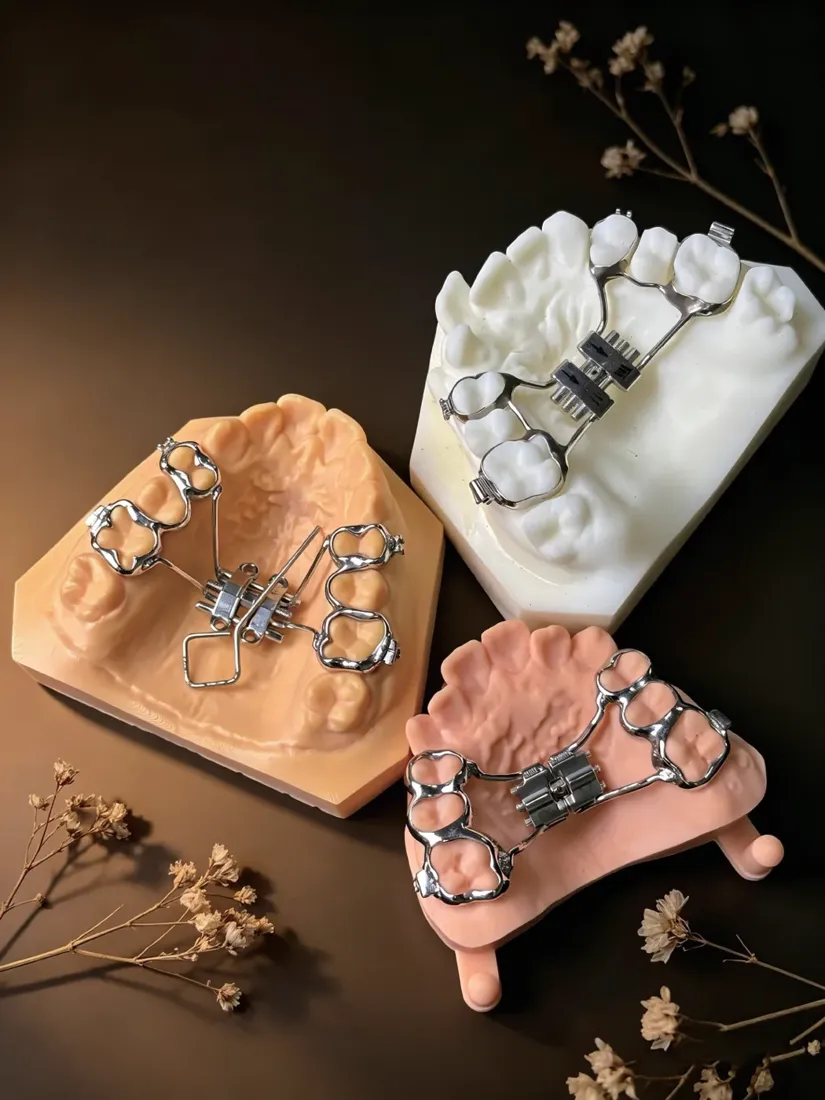 Orthodontic expanders