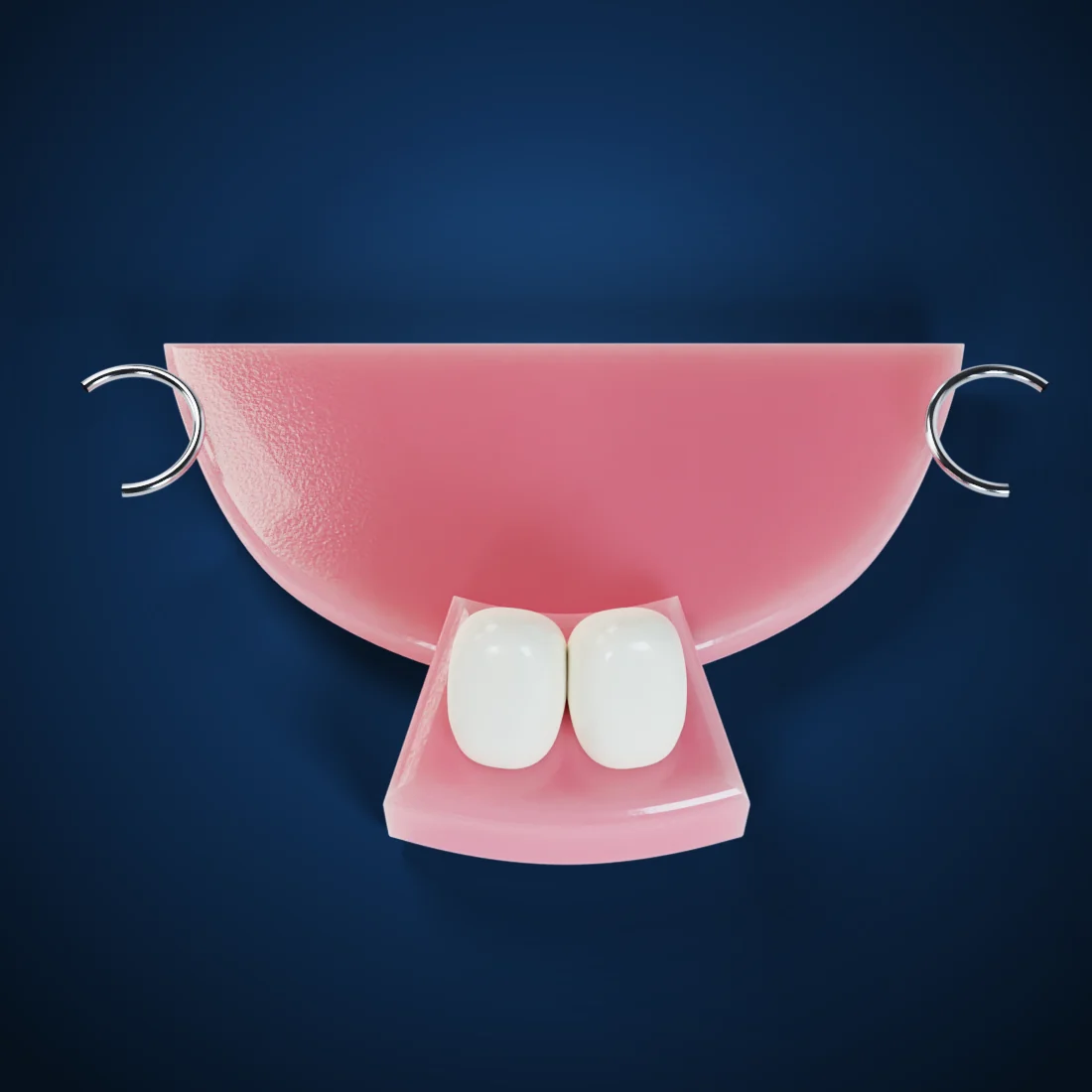 Acrylic partial dentures & flippers (3D render)