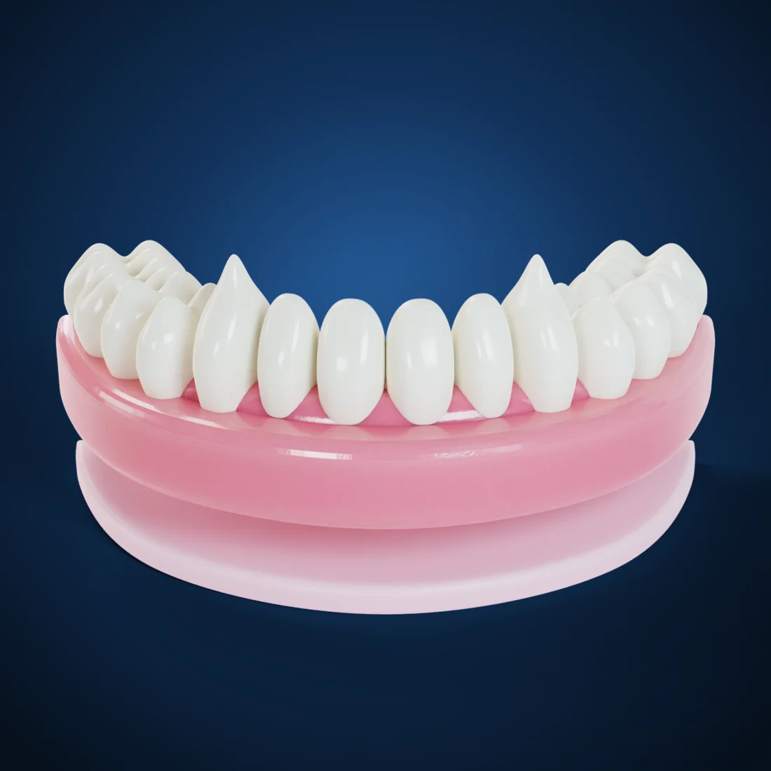 Denture relines & repairs (3D render)
