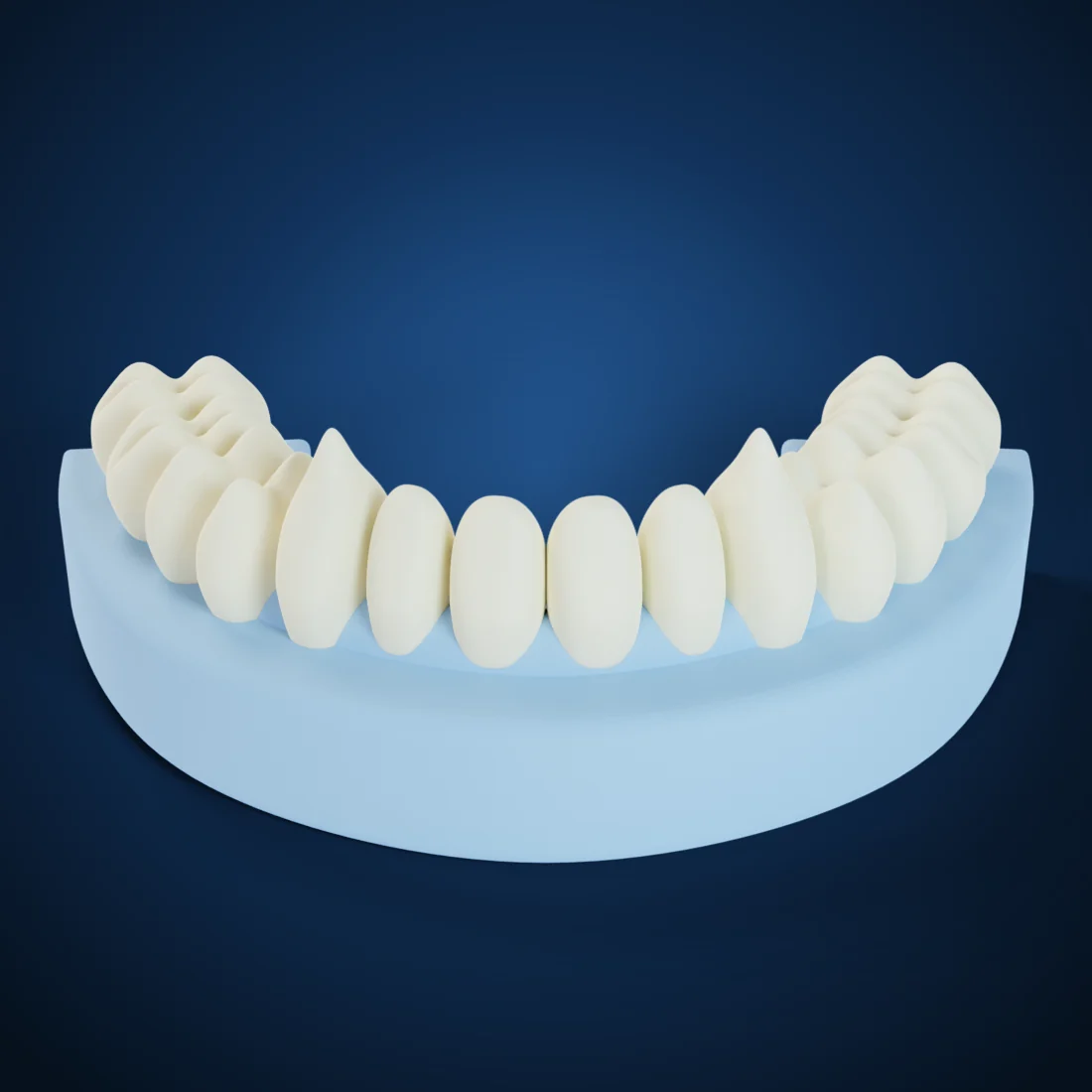 Diagnostic wax-ups (3D render)