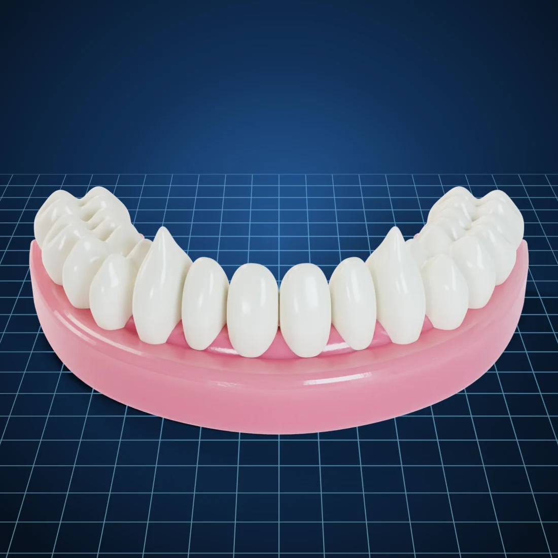 Digital dentures (3D render)
