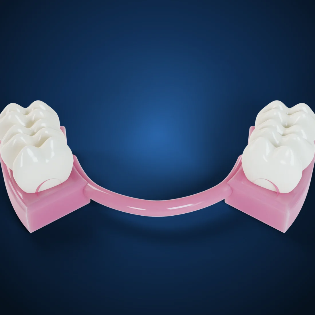 Flexible dentures (3D render)