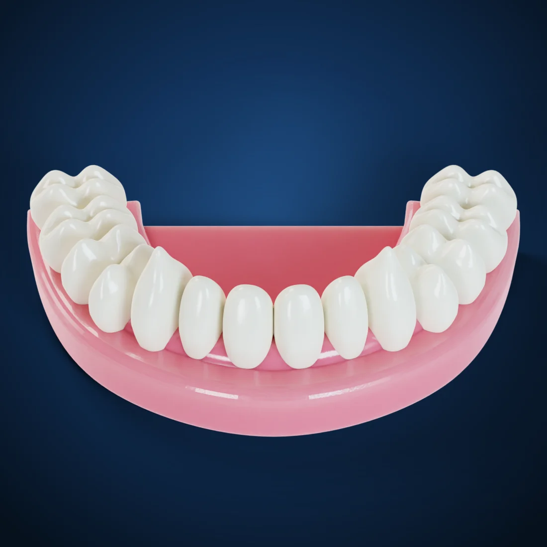 Immediate dentures (3D render)