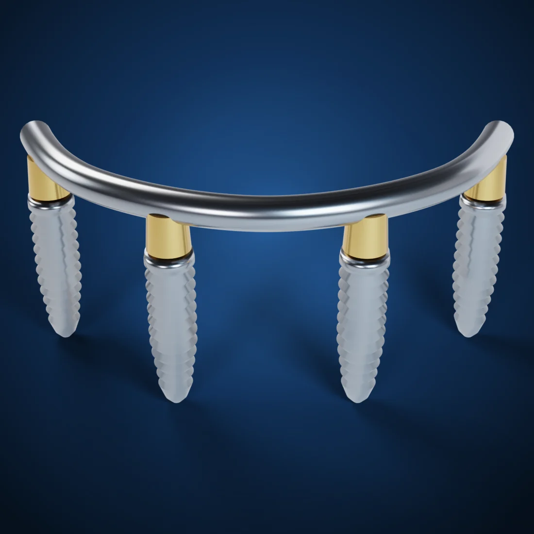 Implant bars (3D render)