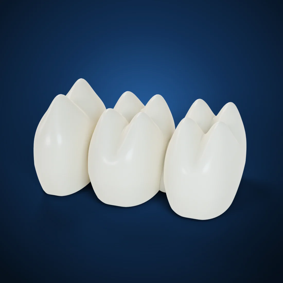 PMMA provisional crowns & bridges (3D render)