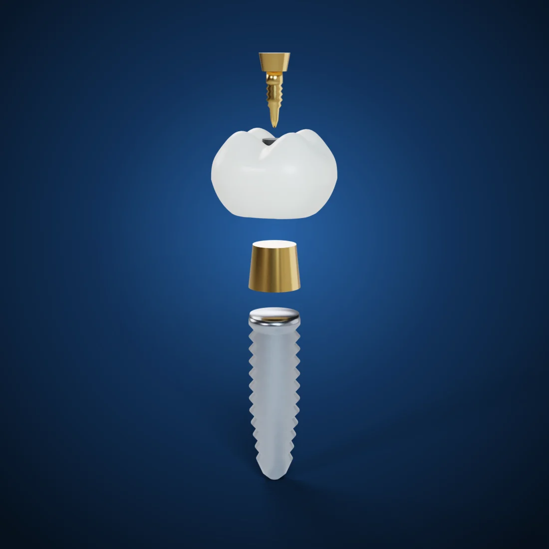 Cement- & screw-retained implant crowns (3D render)