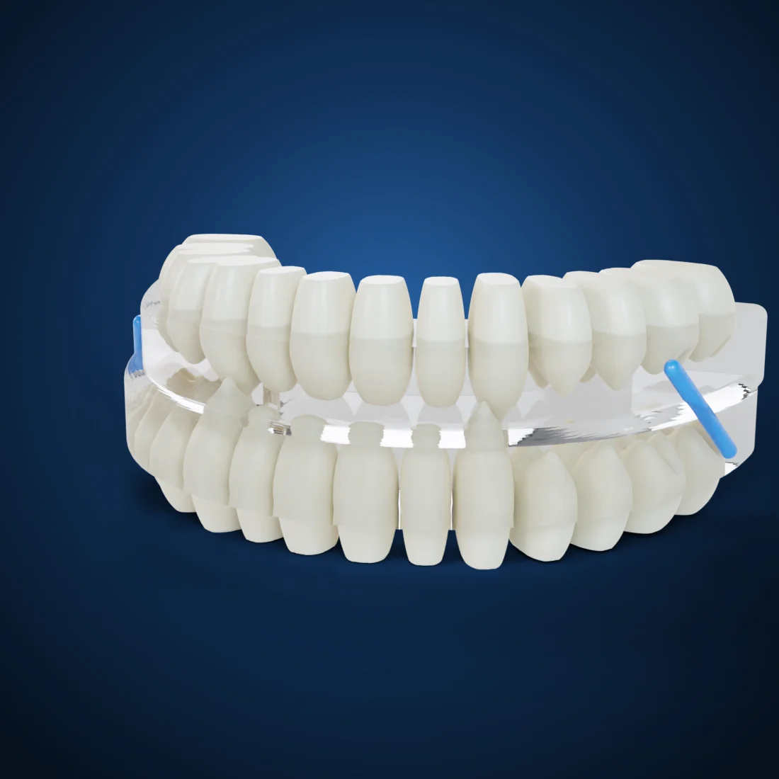 Snoring & sleep apnea appliances (3D render)
