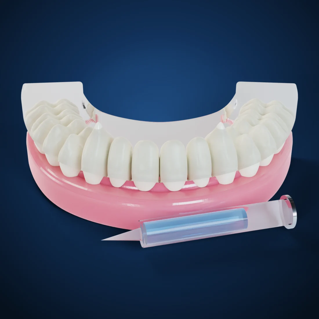 Whitening trays (3D render)